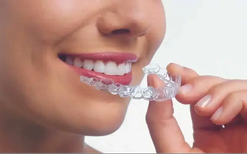 Invisalign-and-Other-Clear-Aligners Invisalign